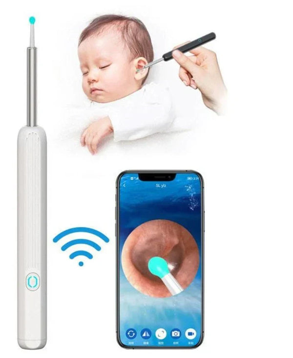 Earwax Removal Kit CASANOOR